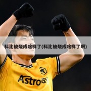 科比被烧成啥样了(科比被烧成啥样了啊)